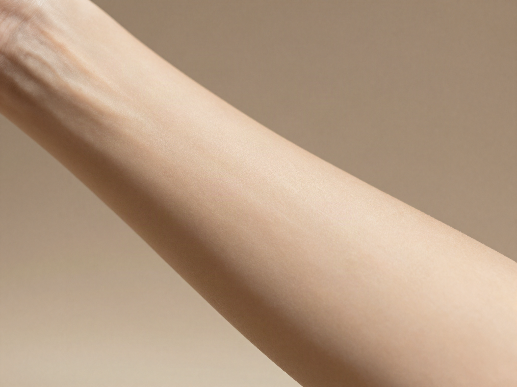 Stretch Marks